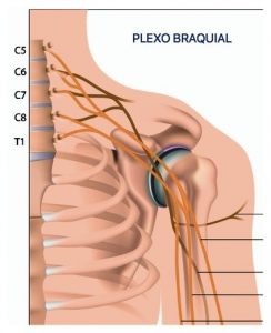 Tratamento das lesões do plexo braquial